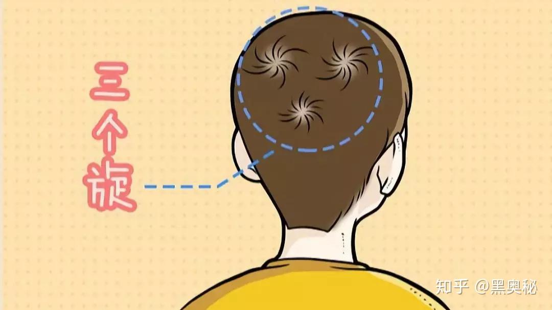 人的头发为什么都有旋？ - 知乎