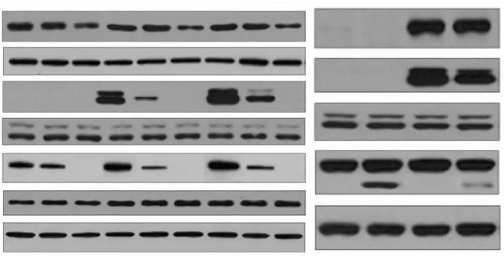 学术小白如何吃瓜一招鉴别出ps拼接的免疫印迹图