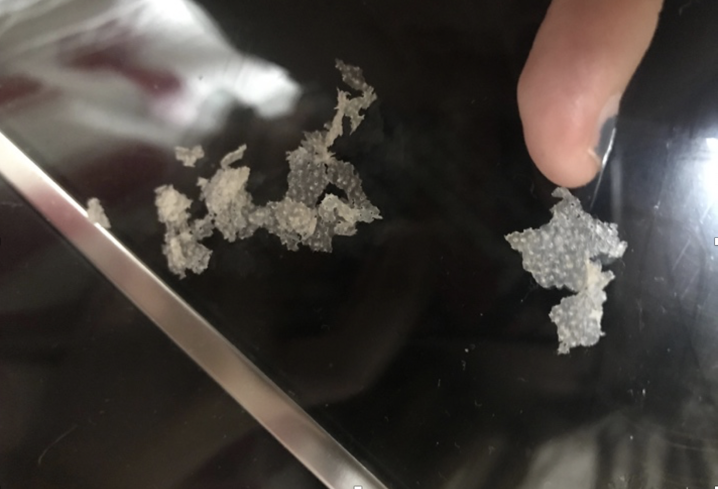 头皮屑很严重,洗完头干了之后,头皮上就是一层,摸上去像疙瘩,总忍不住