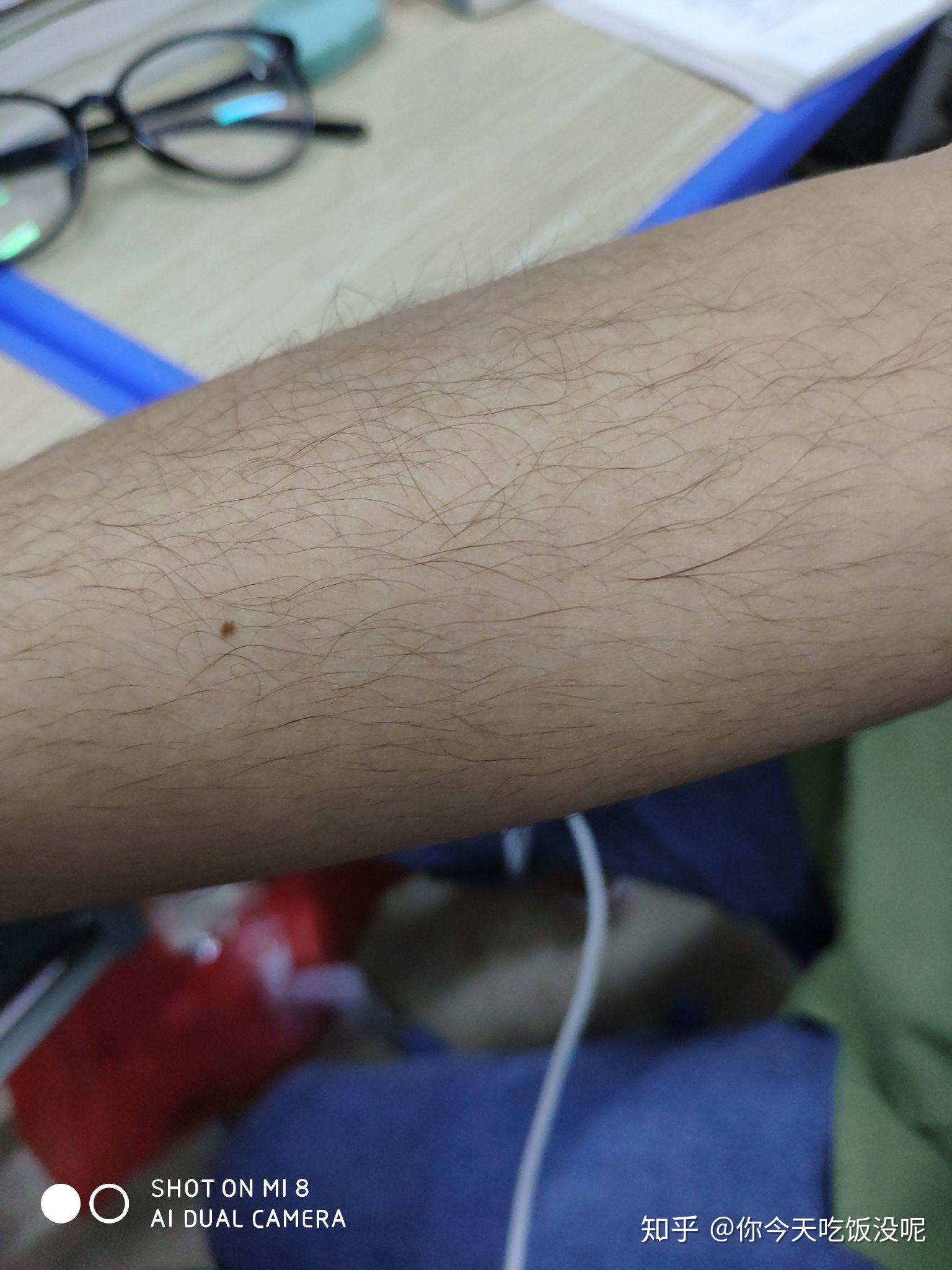 女生长浓密手毛是一种什么样的体验