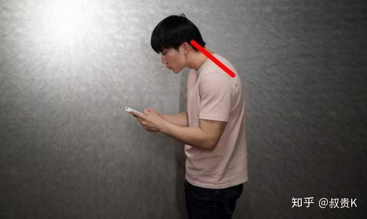 现代人都变得有头部前倾的的倾向了吗应如何预防