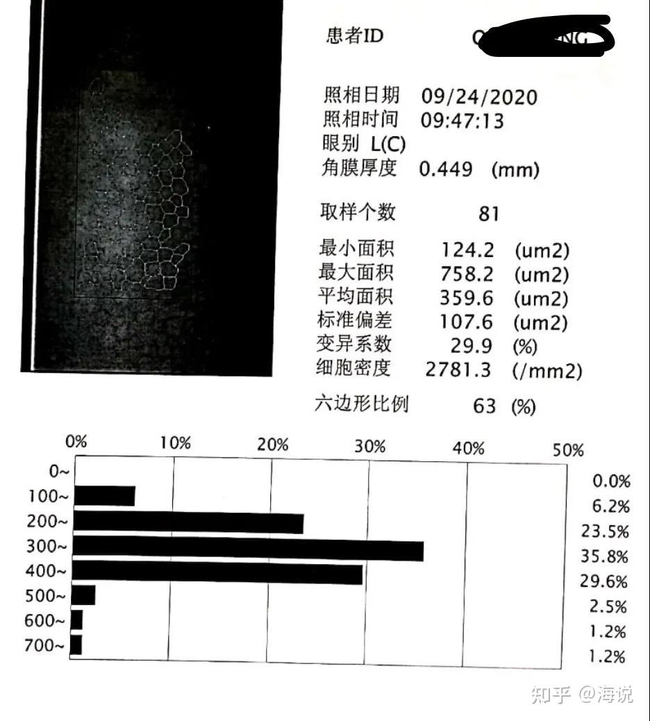 角膜内皮计数图片