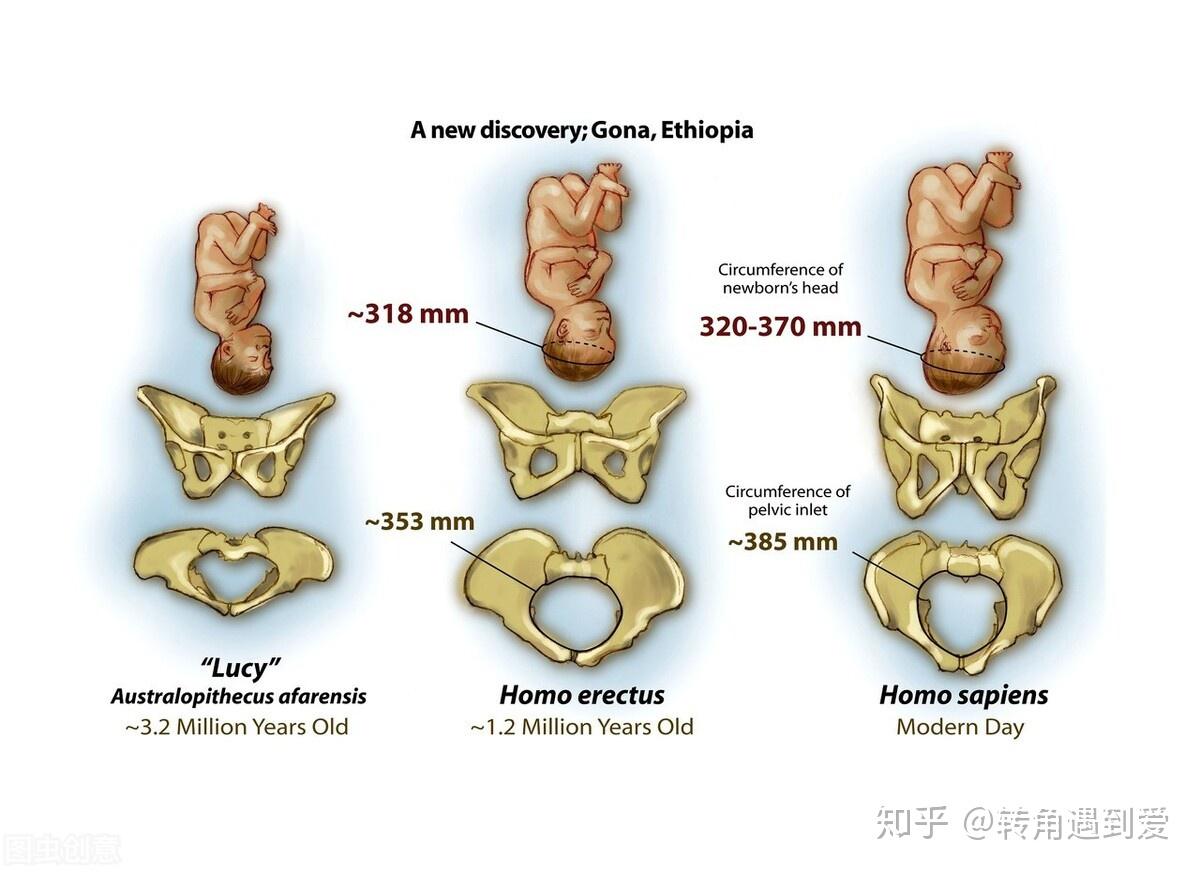 不專業的,因為做骨盆修復,只是對胯骨內收的話,這並不是真正意義上