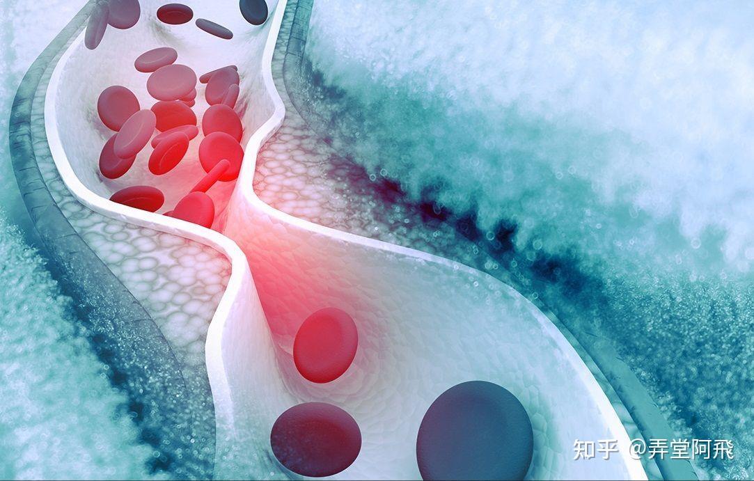 血管炎的致病原因是什么?该如何治疗呢? - 知乎