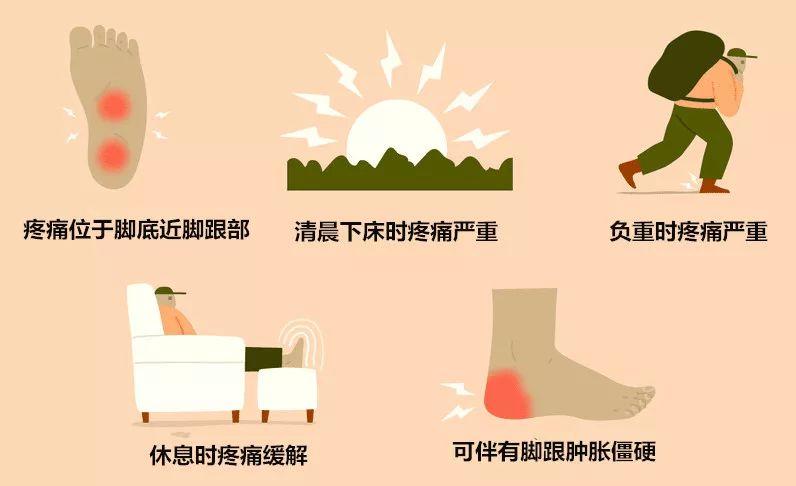 医生提醒脚跟痛别耽误当心是足底筋膜炎