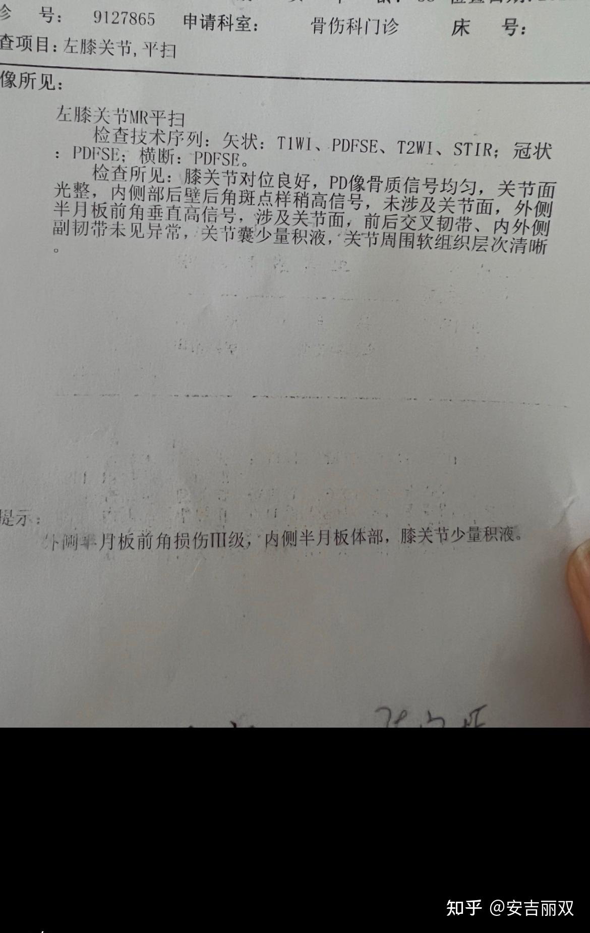 半月板损伤保守治疗纪录 