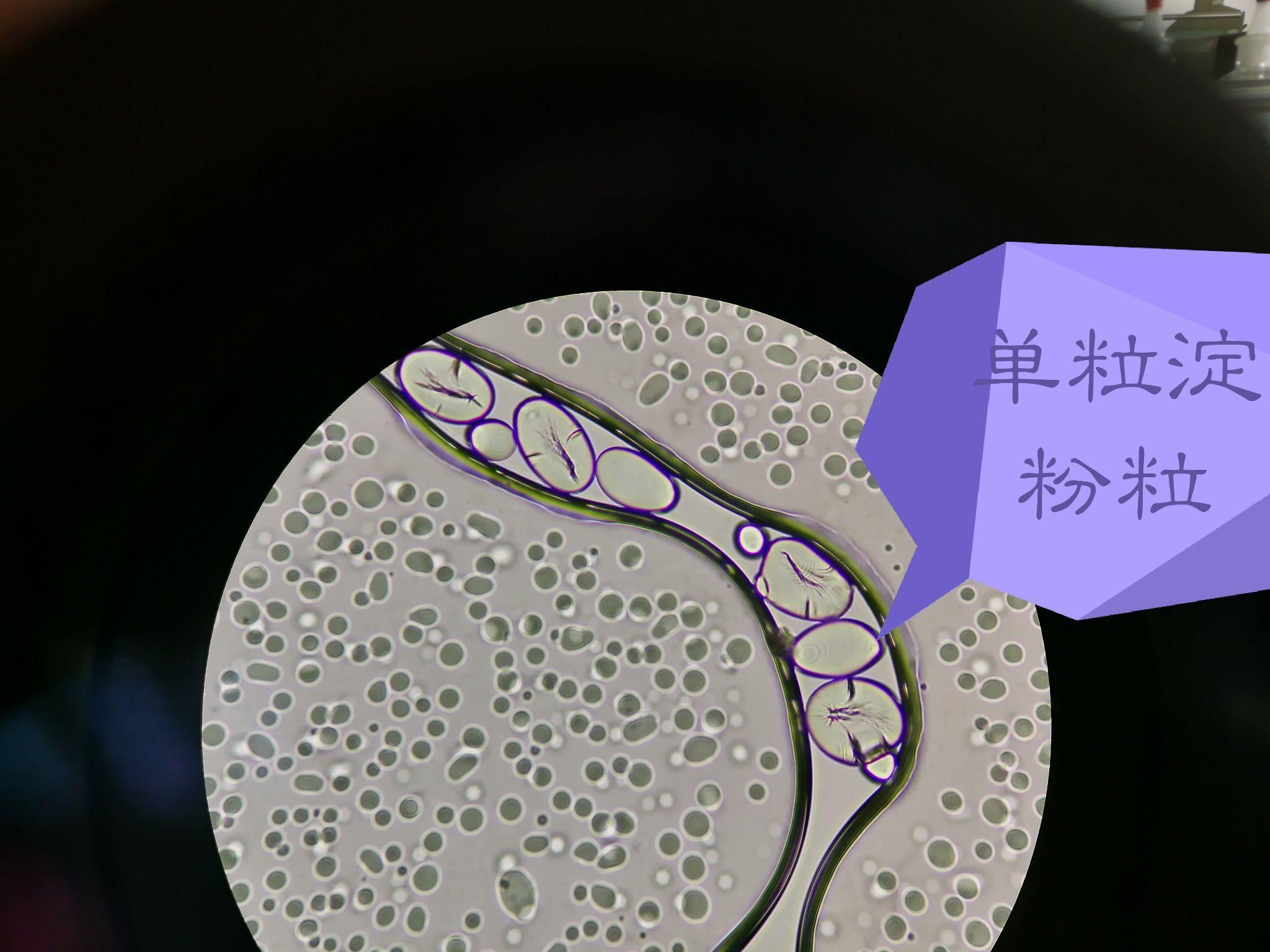 关于单粒淀粉粒复粒淀粉粒半复粒淀粉粒的结构