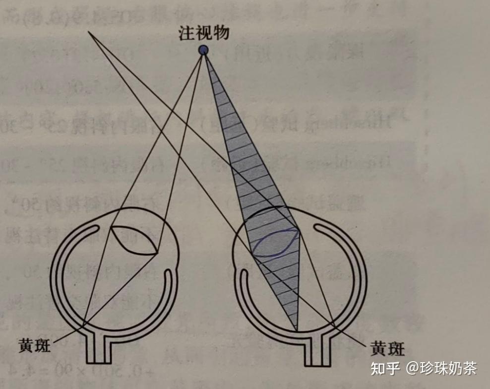 斜視性弱視 - 知乎