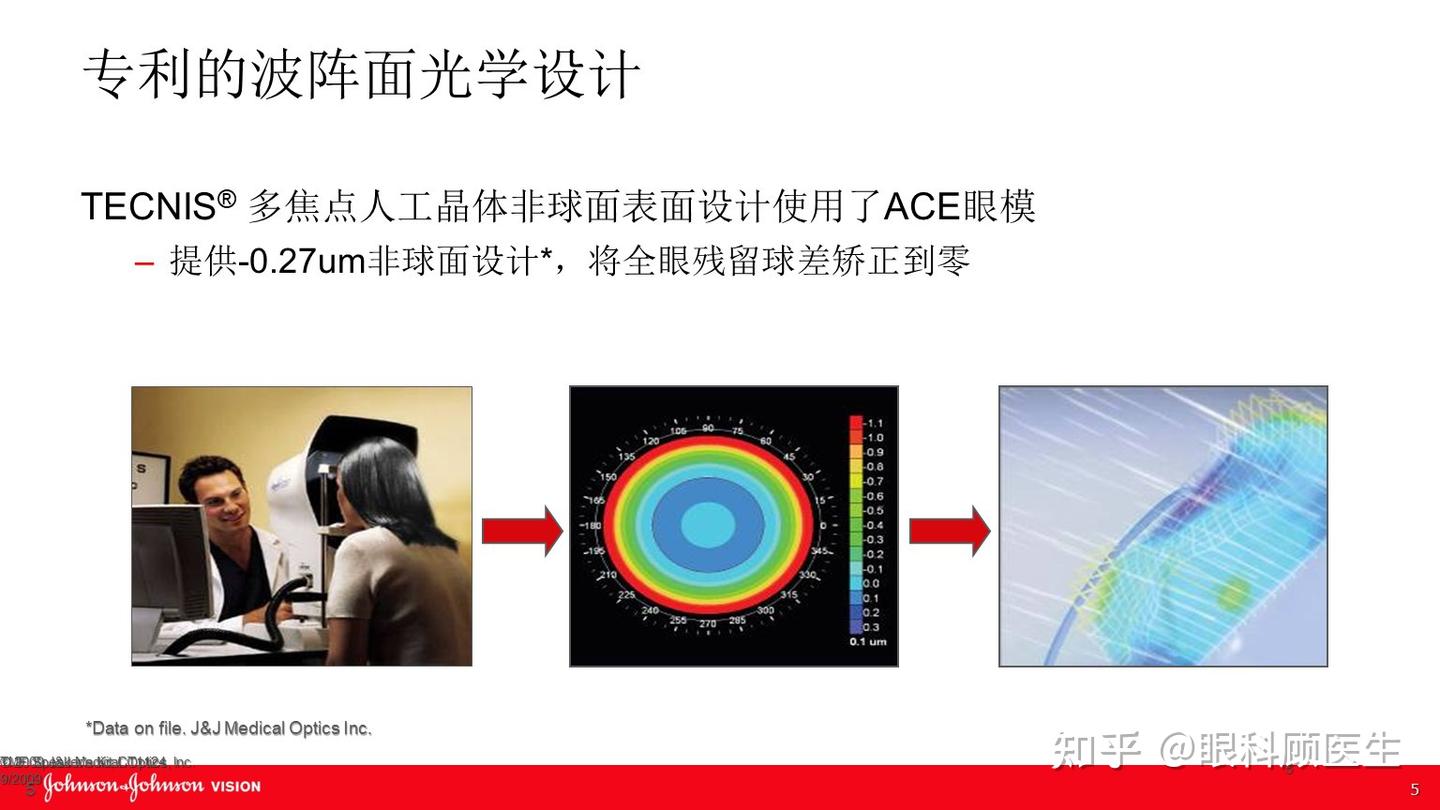 Zmb00 眼力健双焦点人工晶体-ZMB00的特点 - 知乎