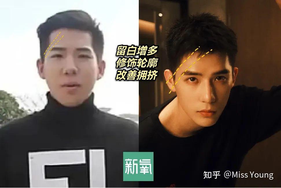 王安宇是不是整容了? - 知乎