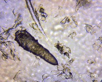 怎么除去螨虫 v2-c445e41103b3d712d60fb08a2d2593a8_b.jpg