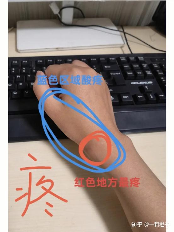 v2-c46817b6974c54455fd16b0b31cc301c_r.jpg