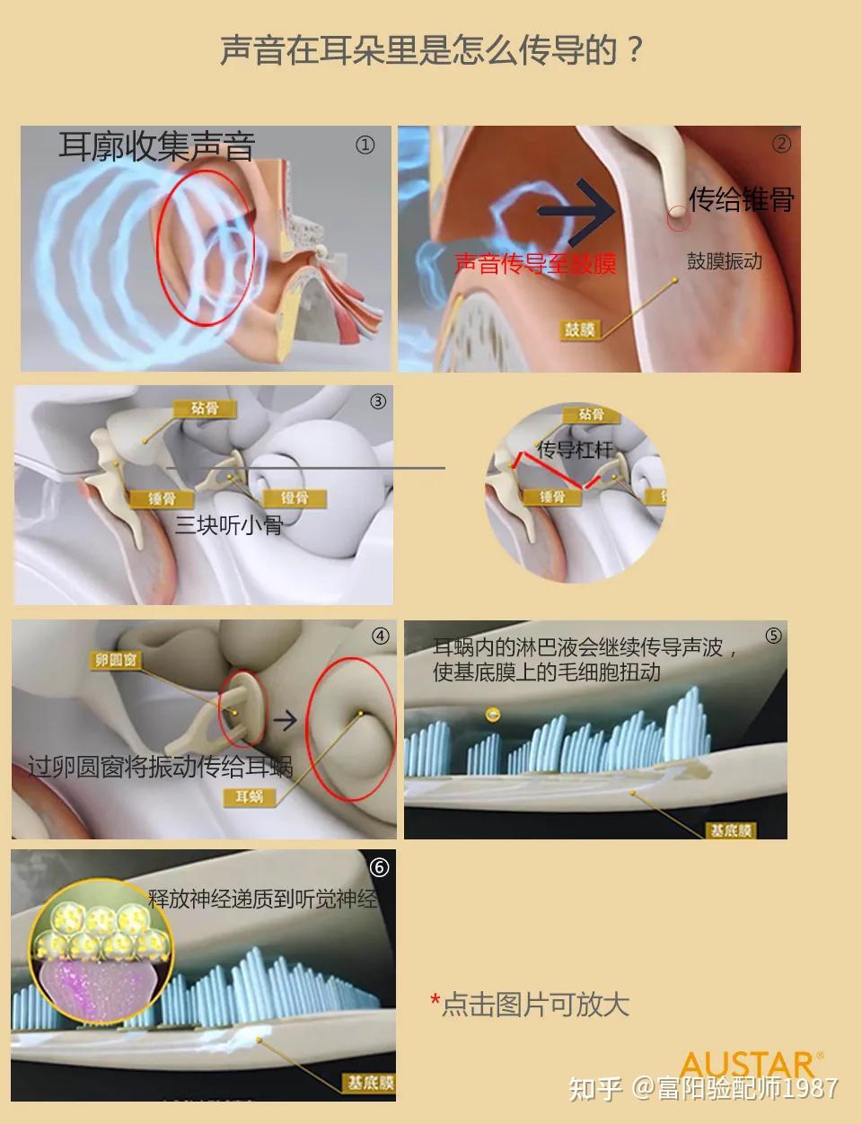 人工听骨正规图片图片