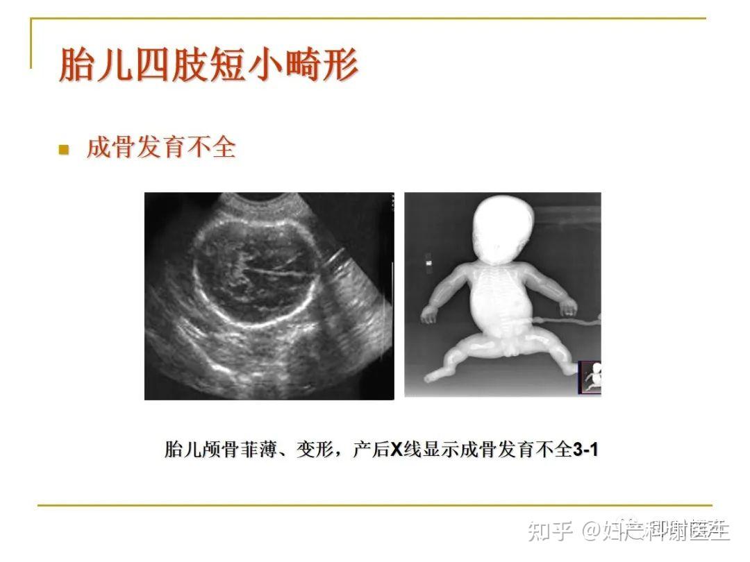 B超检查能100％检查出胎儿畸形吗？--中国数字科技馆