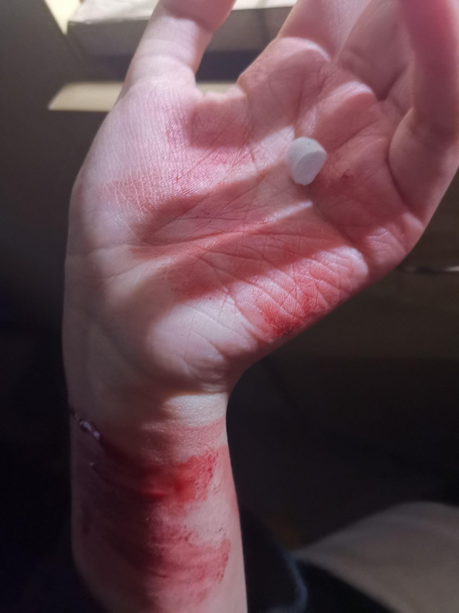 自残属于什么心理