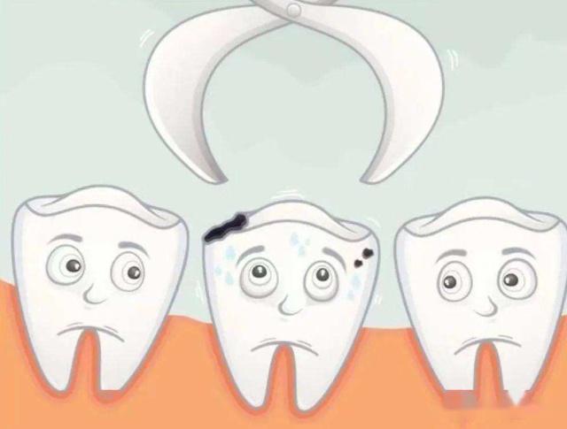 第二种:保留残根牙修复保留牙齿残根的修复我们一把采用全瓷牙.