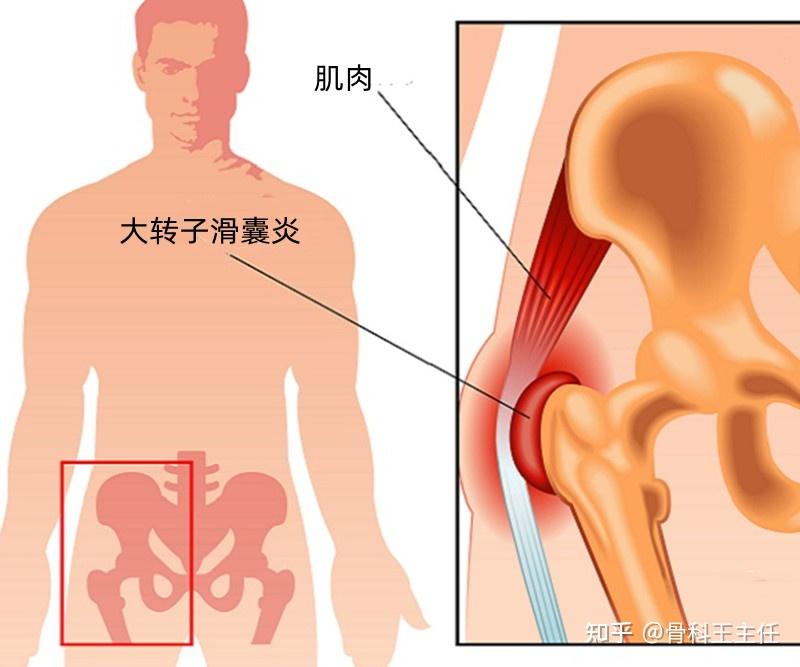 屁股疼痛是什么原因,什么情况要去医院,该挂哪个科?