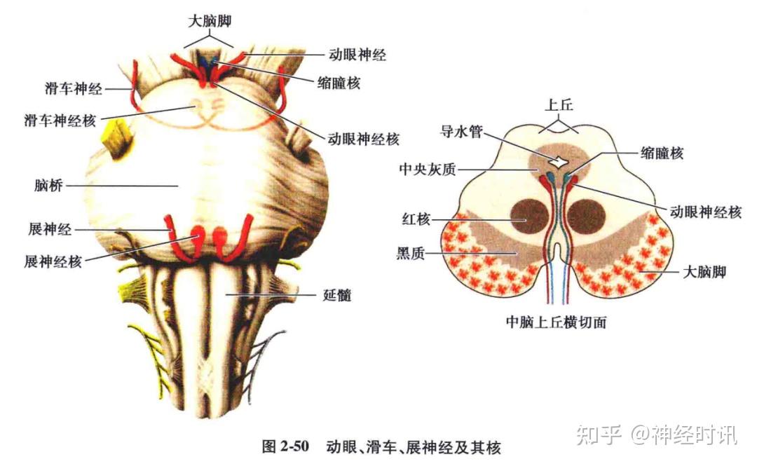 内侧纵束解剖图图片