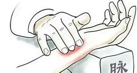 切脉针灸学习笔记——致敬俞云俞老 - 知乎