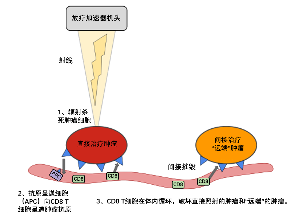 晚期 转移性癌症患者 放疗联合免疫治疗的远隔效应可使生存翻番 知乎