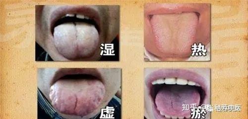 中医舌诊口诀！建议收藏！ - 知乎