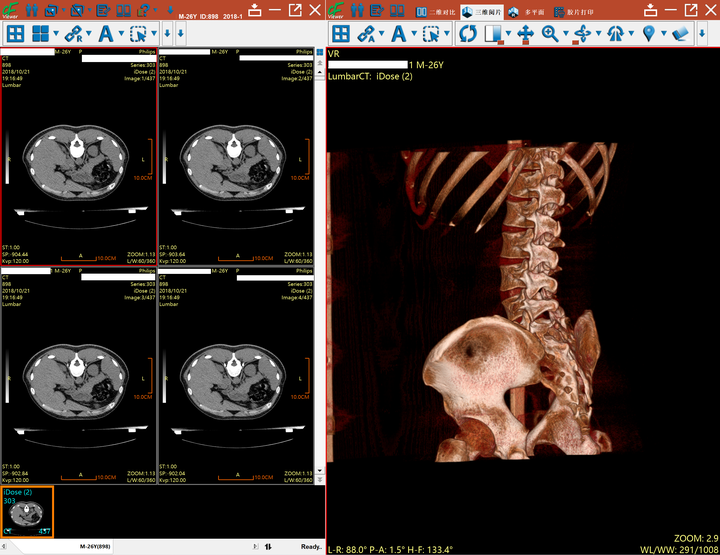 DICOM 医学图像浏览器 (DICOM Medical Image Viewer） - 知乎