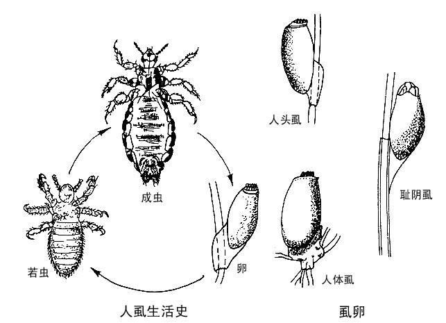 阴虱病怎么预防？怎么治疗？