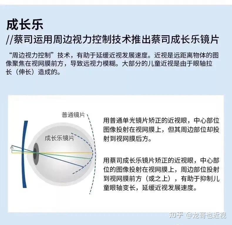 蔡司成长乐镜片怎么样? - 知乎