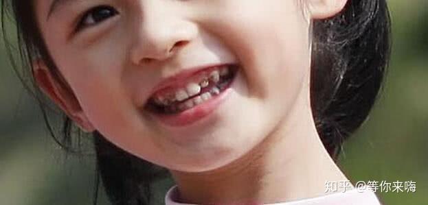 常州奶牛叔叔:小孩牙齿黑是缺钙吗?小孩牙齿发黑怎么办?