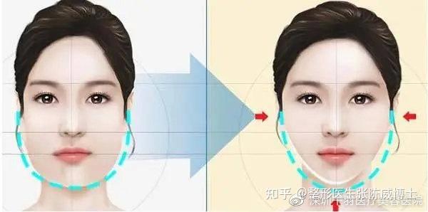 人到中年为什么会发腮?需要怎么补救? - 知乎