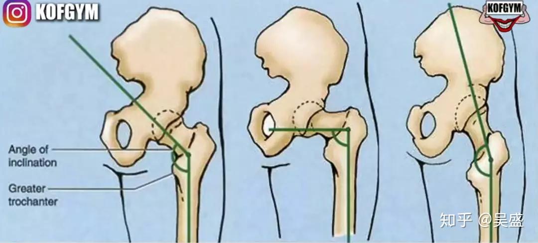 曲腿硬拉、直腿硬拉、相扑硬拉,三者的区别在