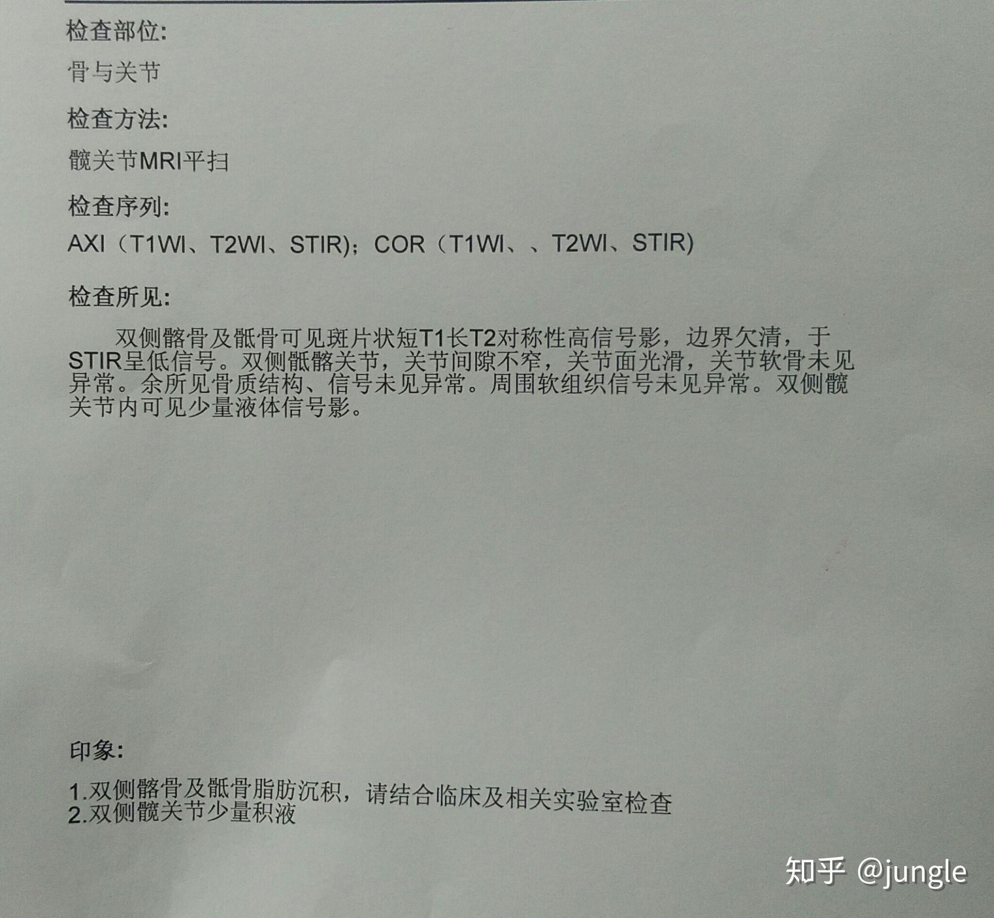 25~~~~~~~~~~~~~~~~~~~~~~~~~~~~~目前状态,b27阴性,核磁和ct结果都