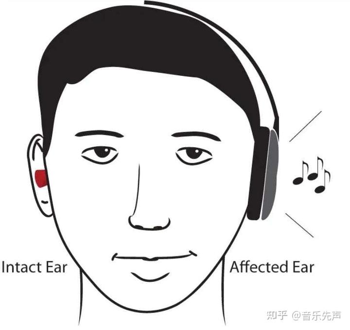 听障宝宝如何欣赏音乐? 5 v2 c6c0279d01cb2477a429bc9ce17c62a0 720w