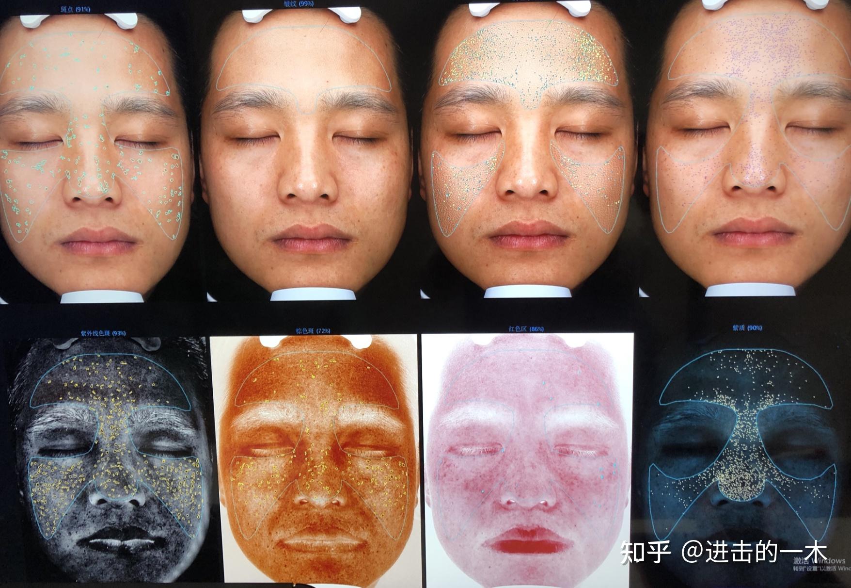 LED光疗美容仪/光疗面具/光子嫩肤体验分享 - 知乎
