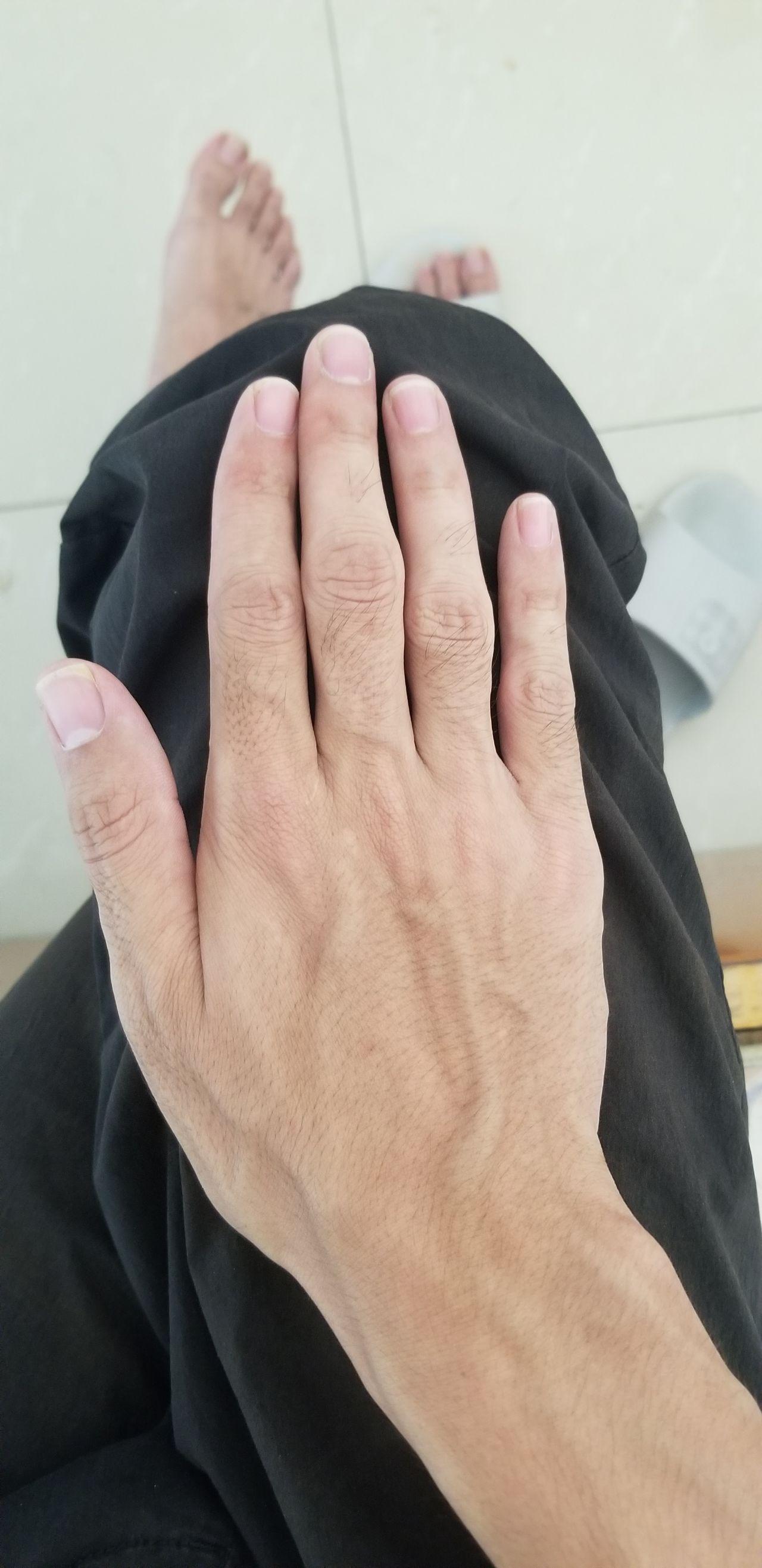 手指上长毛是一种什么样的体验? - 知乎