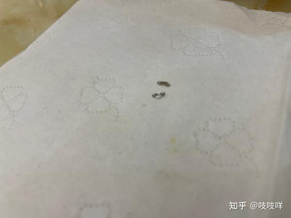 2023年春节包皮环切手术有感 - 知乎