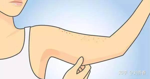 怎么去鸡皮肤穿搭夏季学生党(鸡皮肤的女生都怎么穿的裙子啊)