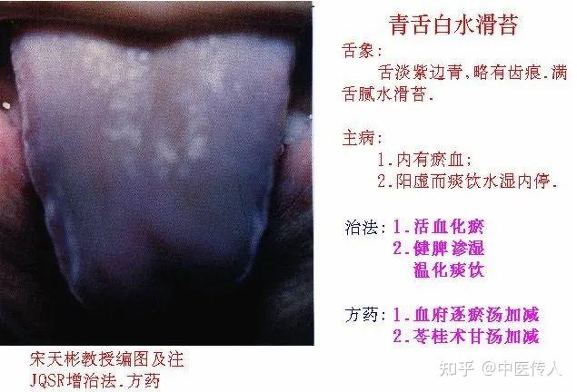 高清舌诊图解:各种临床证型舌象图谱大开眼界 - 知乎