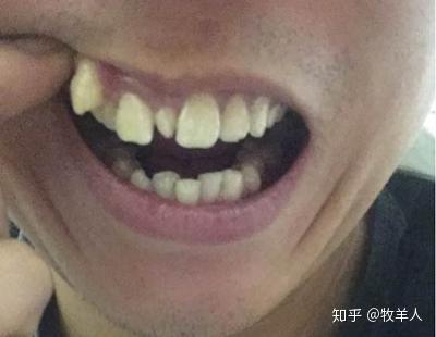 v2-c78189e7b8d86556c83ca460bb5095bc_b.jpg