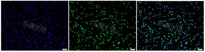 细胞凋亡检测实验之《tunel染色》 知乎