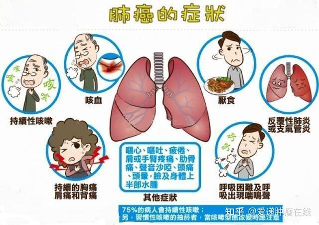 肺癌轉移率這麼高這些細節別忽略