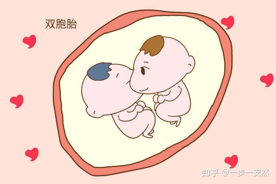 多胎妊娠是怎么一回事？ - 知乎