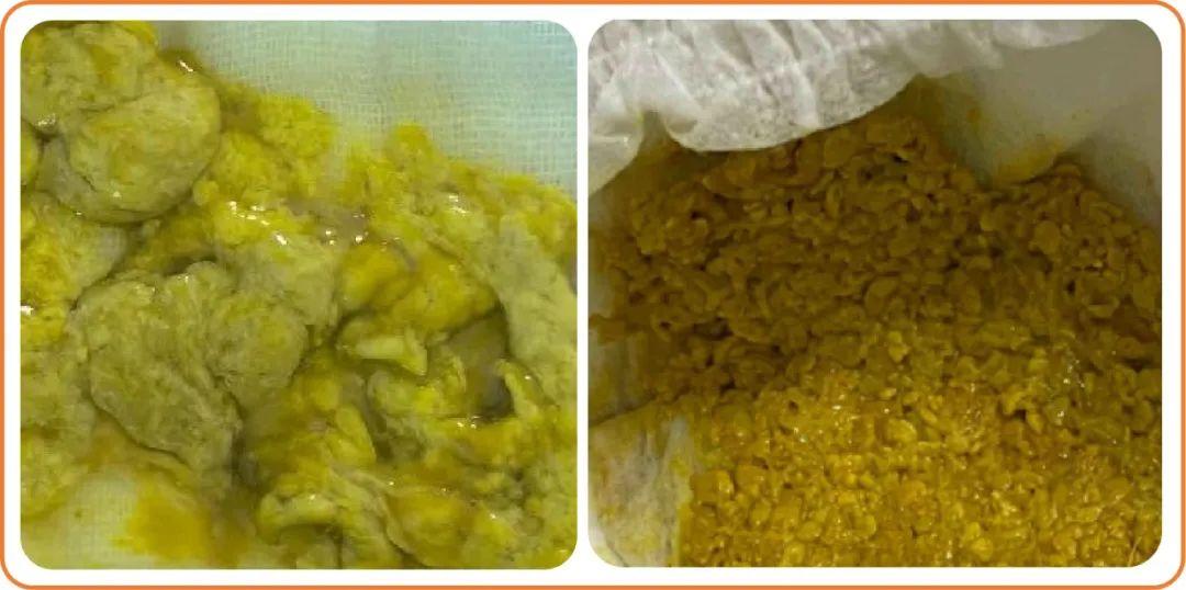 注意!宝宝便秘、奶瓣、油状便、绿便、腹泻……都可能是因为奶粉中的TA消化吸收不好 - 知乎
