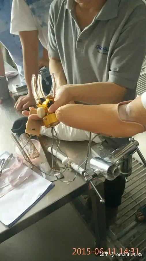 假肢装配前的必修课