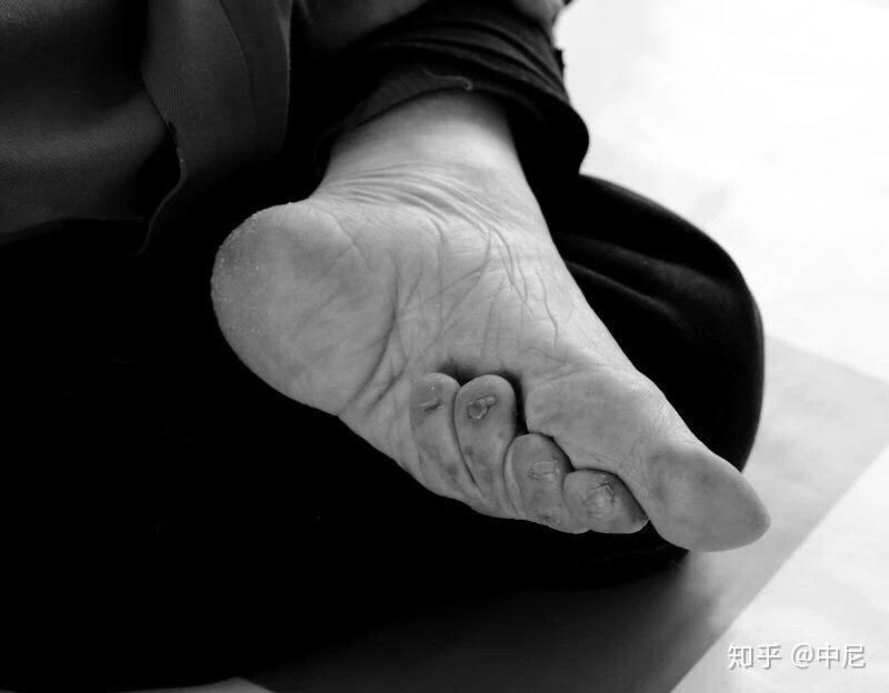 21世纪的缠足女人们