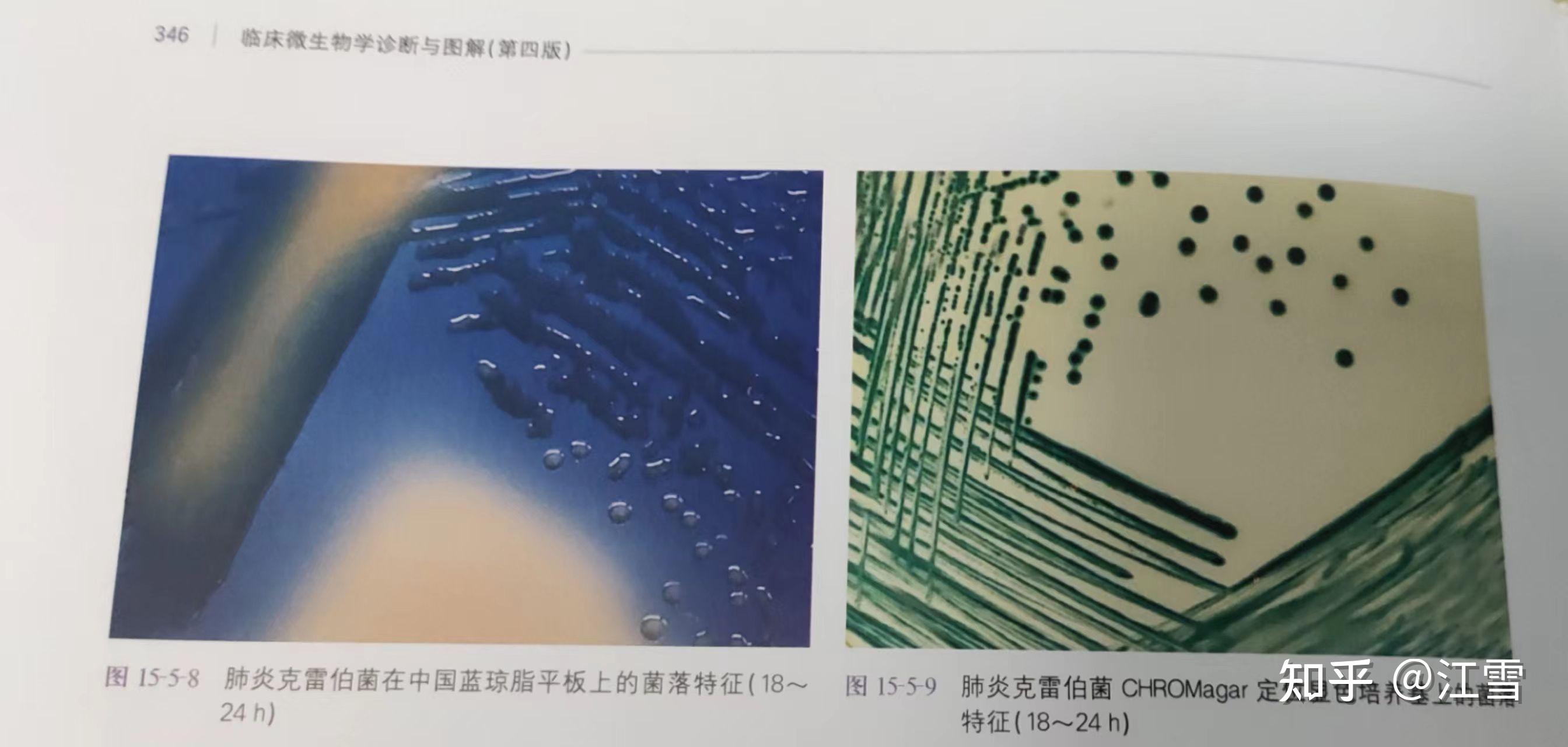 临床微生物学诊断与图解(第四版)上册 克雷伯菌属 344页 - 知乎