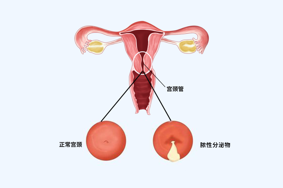 产后正常宫颈图片大全图片