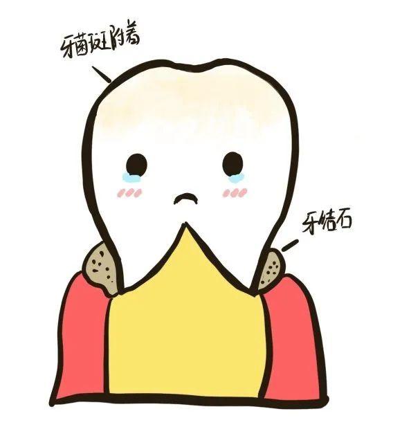 中国97%的成年人都患有的口腔问题:牙结石