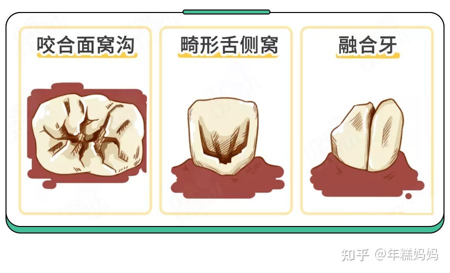 5歲兒童蛀牙率70別隻控糖了這件事更要緊