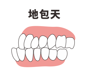 用雪糕棍咬咬就能矫正地包天?什么是咬撬法?